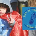 Step Up Down Syndrome RGV